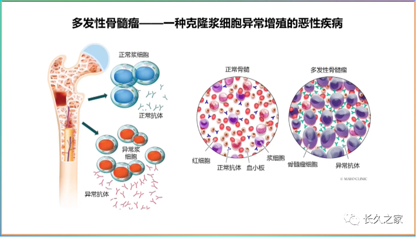 4a2bdd9411a29972e347d10a65c61b2e.png