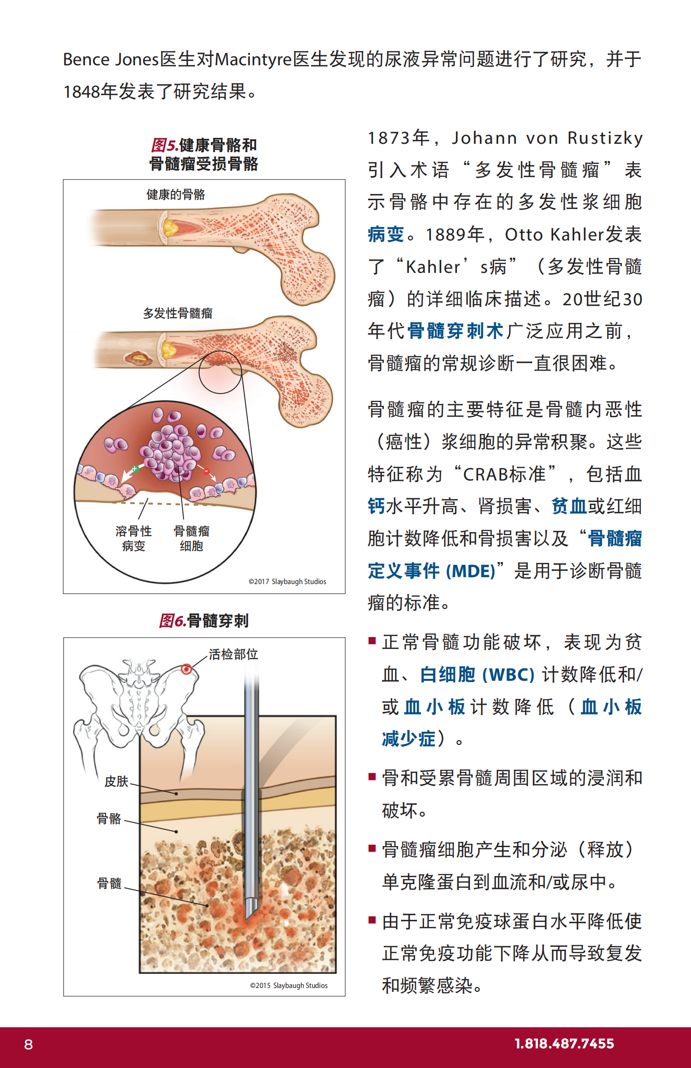 IMF 复发和难治性骨髓瘤简明综述 Chinese (PRC)_CR_EN_2023_07.png