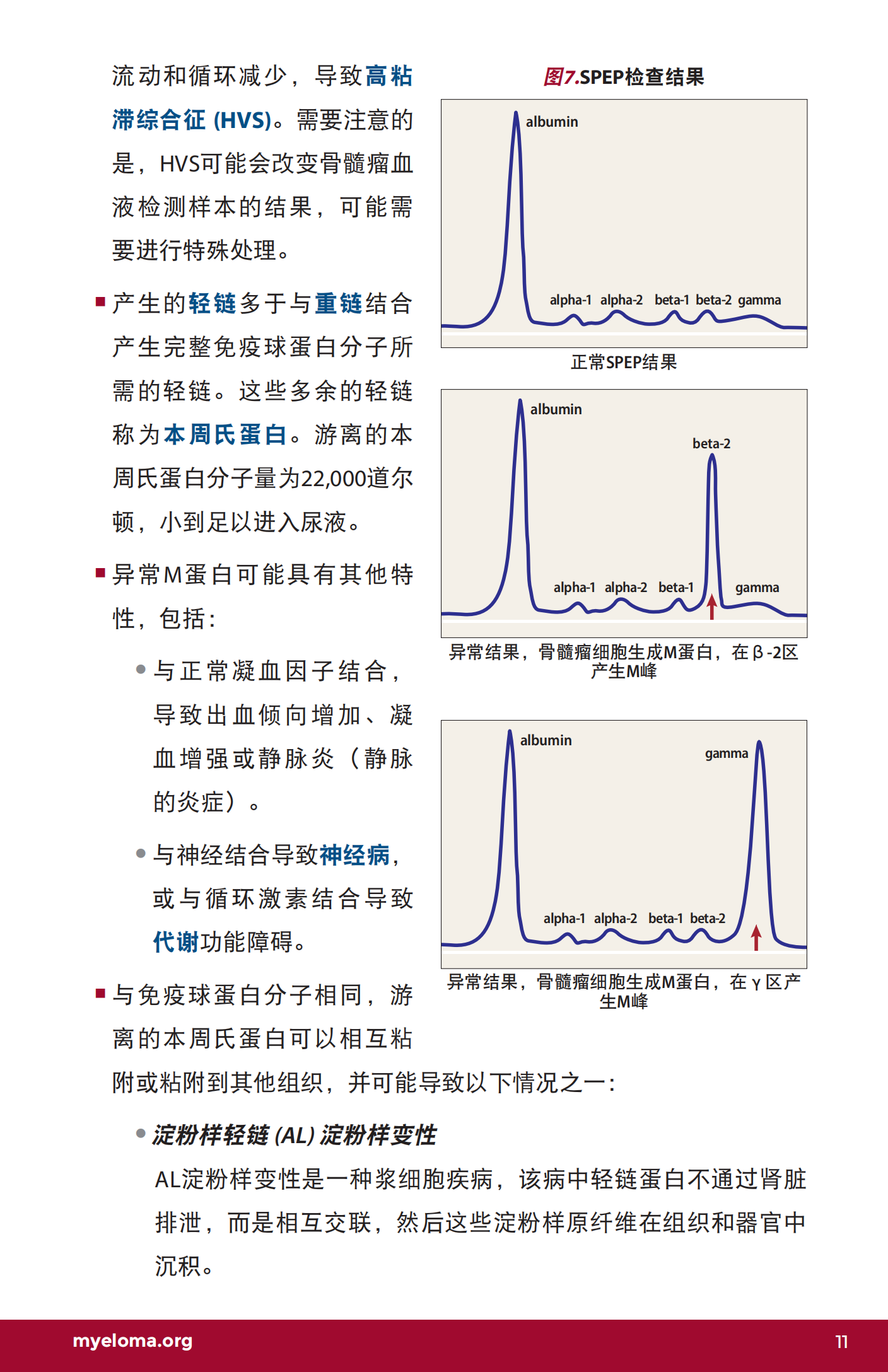 IMF 复发和难治性骨髓瘤简明综述 Chinese (PRC)_CR_EN_2023_10.png