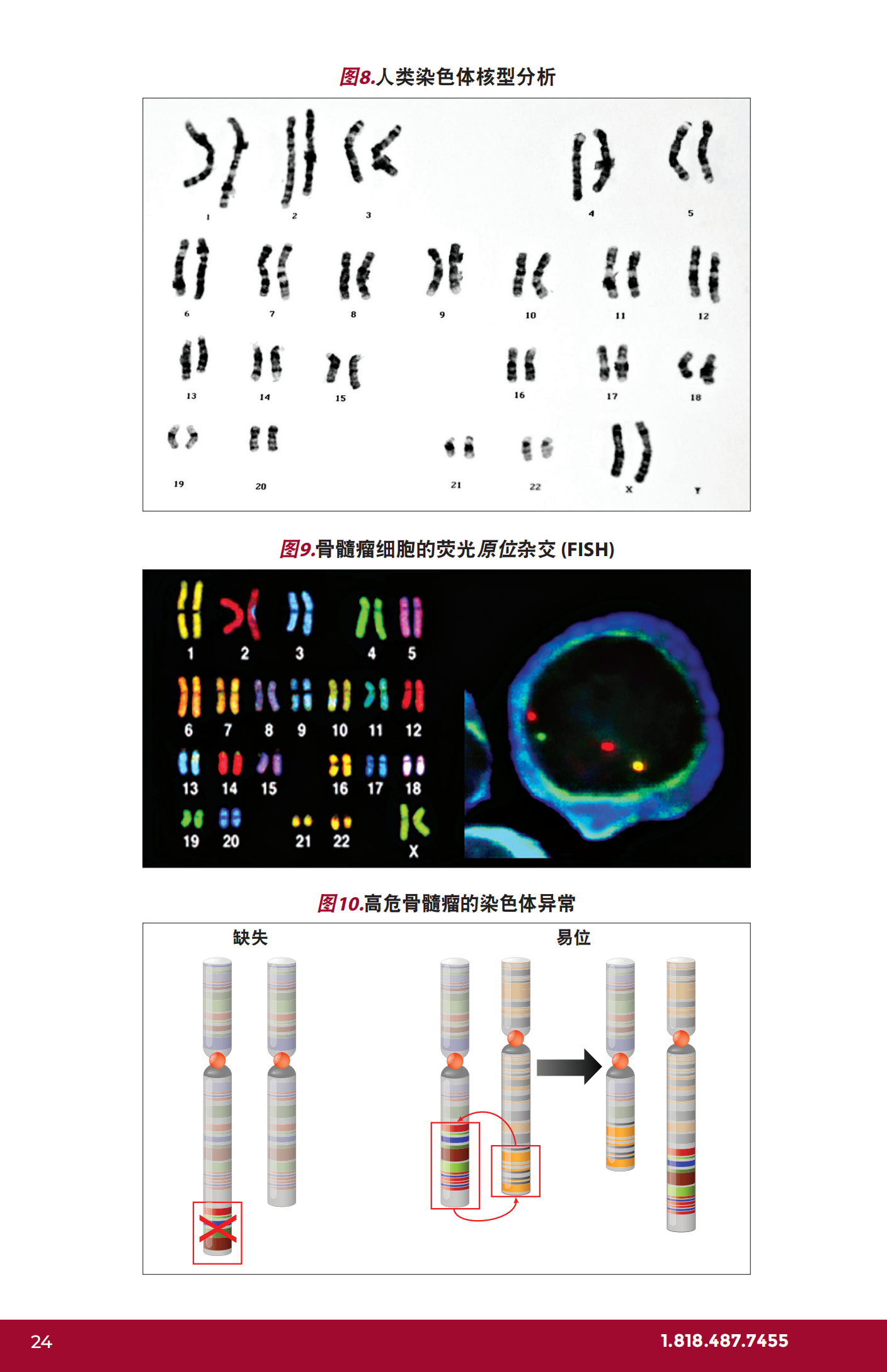 IMF 复发和难治性骨髓瘤简明综述 Chinese (PRC)_CR_EN_2023_23.png