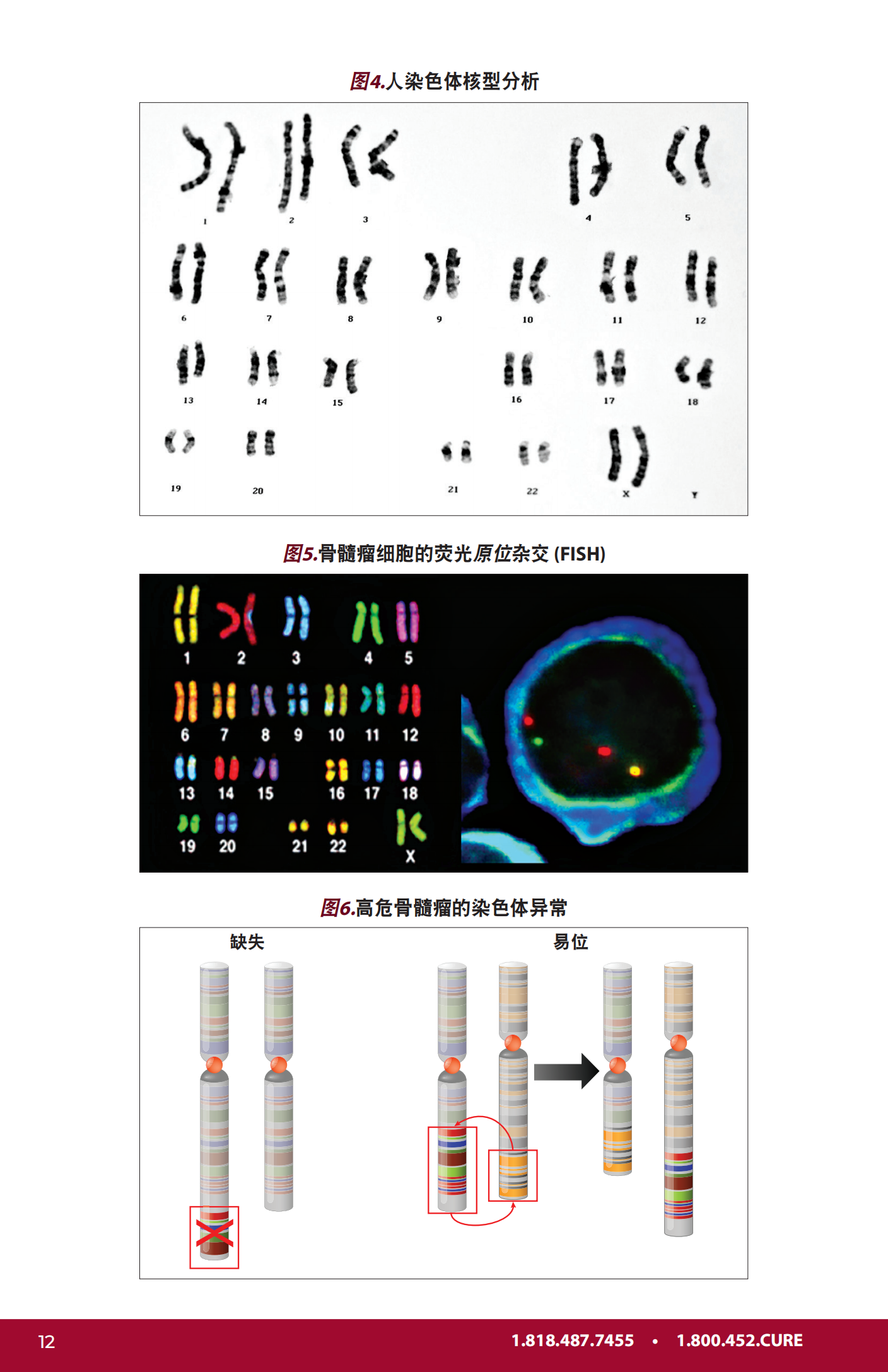 IMF 新诊断患者手册 Chinese (PRC)_PHB_EN_2023_11.png