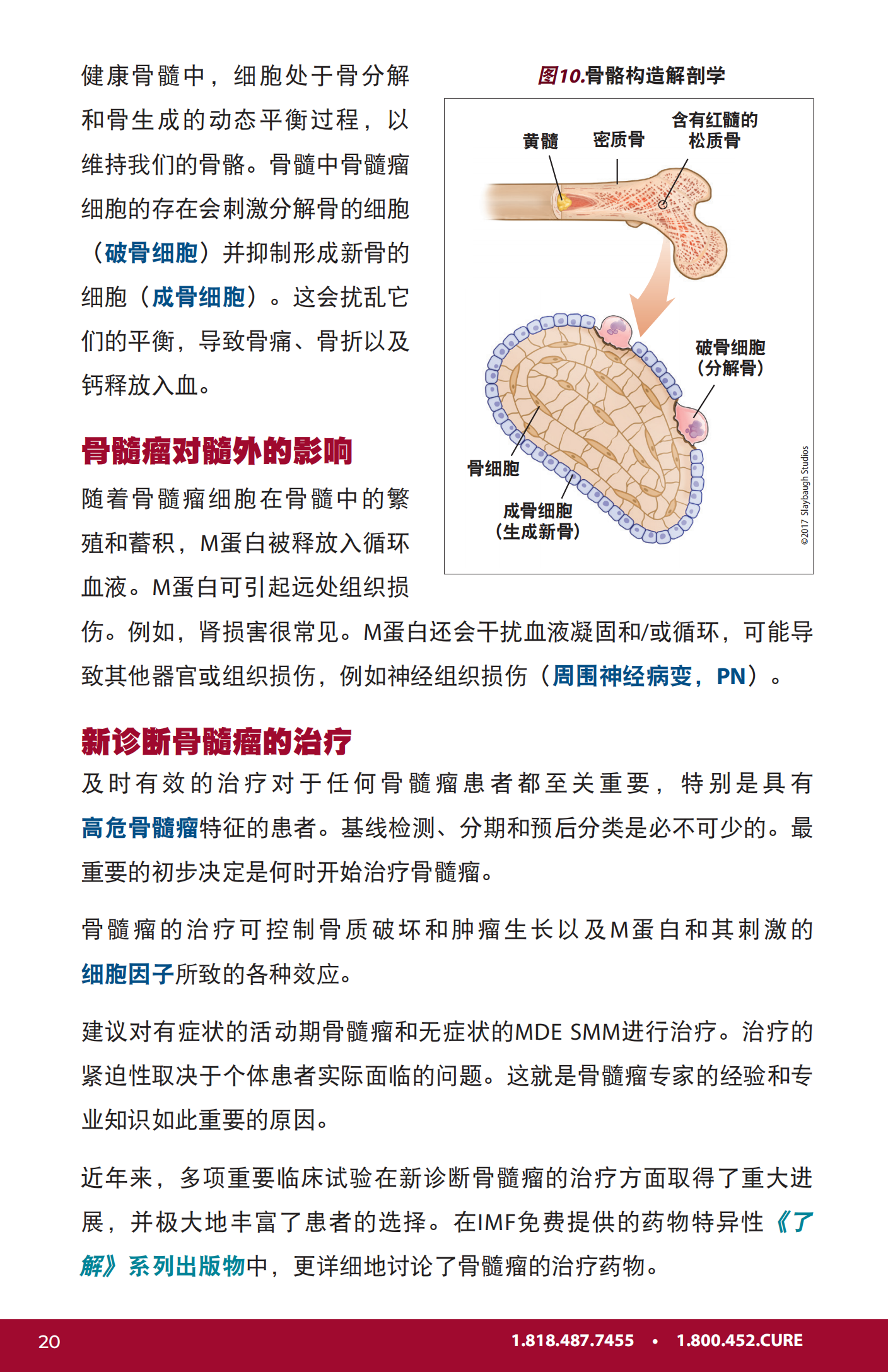 IMF 新诊断患者手册 Chinese (PRC)_PHB_EN_2023_19.png